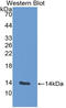 Fatty Acid Binding Protein 3 antibody, LS-C314237, Lifespan Biosciences, Western Blot image 