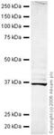 Lysyl Oxidase antibody, ab31238, Abcam, Western Blot image 