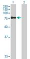 E3 ubiquitin-protein ligase ZSWIM2 antibody, H00151112-B02P, Novus Biologicals, Western Blot image 