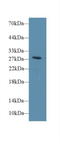 Type III iodothyronine deiodinase antibody, LS-C293665, Lifespan Biosciences, Western Blot image 