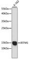 Interferon Induced Transmembrane Protein 1 antibody, A4228, ABclonal Technology, Western Blot image 