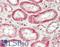 Neurofibromin 1 antibody, LS-B14758, Lifespan Biosciences, Immunohistochemistry paraffin image 