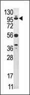 Ubiquitin Specific Peptidase 1 antibody, PA5-11989, Invitrogen Antibodies, Western Blot image 
