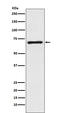 Solute Carrier Family 6 Member 1 antibody, M05109, Boster Biological Technology, Western Blot image 
