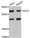 Sclerostin antibody, MBS9128402, MyBioSource, Western Blot image 