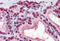 Cellular Retinoic Acid Binding Protein 1 antibody, MBS245370, MyBioSource, Immunohistochemistry frozen image 