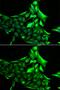 Glycogen Phosphorylase B antibody, GTX64469, GeneTex, Immunocytochemistry image 