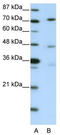 Autophagy Related 4B Cysteine Peptidase antibody, TA335642, Origene, Western Blot image 