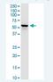 Dihydrolipoamide S-Succinyltransferase antibody, H00001743-M01-100ug, Novus Biologicals, Western Blot image 