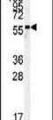 Pyruvate Kinase M1/2 antibody, PA5-13790, Invitrogen Antibodies, Western Blot image 