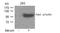 Protein Tyrosine Kinase 2 Beta antibody, GTX50713, GeneTex, Western Blot image 