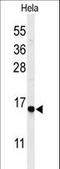 GABA Type A Receptor Associated Protein Like 1 antibody, LS-C166314, Lifespan Biosciences, Western Blot image 