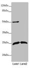 Rho GDP Dissociation Inhibitor Gamma antibody, orb45450, Biorbyt, Western Blot image 