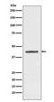 P22907 antibody, M01506, Boster Biological Technology, Western Blot image 