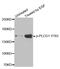 1-phosphatidylinositol-4,5-bisphosphate phosphodiesterase gamma-1 antibody, MBS128482, MyBioSource, Western Blot image 