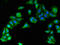 Survival Of Motor Neuron 2, Centromeric antibody, CSB-PA614982LA01HU, Cusabio, Immunofluorescence image 