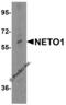 Neuropilin and tolloid-like protein 1 antibody, 6469, ProSci, Western Blot image 