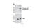 Mitogen-Activated Protein Kinase Kinase Kinase 7 antibody, 4508S, Cell Signaling Technology, Western Blot image 