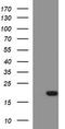 SIVA1 Apoptosis Inducing Factor antibody, LS-C788311, Lifespan Biosciences, Western Blot image 