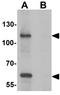 SIK Family Kinase 3 antibody, GTX17162, GeneTex, Western Blot image 
