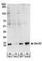 Small Nuclear Ribonucleoprotein D3 Polypeptide antibody, A303-954A, Bethyl Labs, Western Blot image 