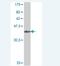 Choline transporter-like protein 1 antibody, H00023446-A01, Novus Biologicals, Western Blot image 