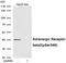 Beta-2 adrenergic receptor antibody, AP55920PU-S, Origene, Western Blot image 