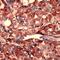 Ribosomal Protein S6 antibody, PA5-32579, Invitrogen Antibodies, Immunohistochemistry frozen image 