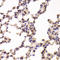 Glycogen Phosphorylase L antibody, LS-C334896, Lifespan Biosciences, Immunohistochemistry frozen image 