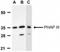 Acidic Nuclear Phosphoprotein 32 Family Member E antibody, NBP1-77227, Novus Biologicals, Western Blot image 