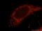 Mitochondrial Antiviral Signaling Protein antibody, 14341-1-AP, Proteintech Group, Immunofluorescence image 