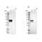 Keratin, type I cytoskeletal 23 antibody, NBP1-85596, Novus Biologicals, Western Blot image 