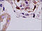 Serpin Family B Member 7 antibody, 251311, Abbiotec, Immunohistochemistry paraffin image 
