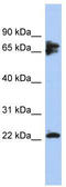 Protein Phosphatase 3 Regulatory Subunit B, Alpha antibody, TA335156, Origene, Western Blot image 