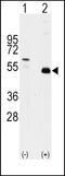 TNF receptor-associated factor 2 antibody, PA5-14962, Invitrogen Antibodies, Western Blot image 