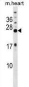 Potassium Voltage-Gated Channel Interacting Protein 4 antibody, abx029054, Abbexa, Western Blot image 