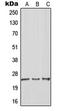 Rho GDP Dissociation Inhibitor Gamma antibody, MBS822223, MyBioSource, Western Blot image 