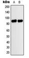 Microtubule Affinity Regulating Kinase 1 antibody, LS-C354244, Lifespan Biosciences, Western Blot image 