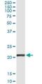 C-Type Lectin Domain Family 1 Member B antibody, H00051266-M02, Novus Biologicals, Immunoprecipitation image 