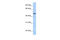 Calcitonin Receptor Like Receptor antibody, 25-752, ProSci, Western Blot image 