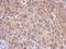 Hypoxia Inducible Factor 1 Subunit Alpha Inhibitor antibody, GTX116251, GeneTex, Immunohistochemistry paraffin image 