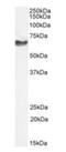 Neurofilament Light antibody, orb1796, Biorbyt, Western Blot image 