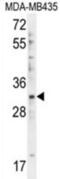 DTW Domain Containing 1 antibody, abx026307, Abbexa, Western Blot image 