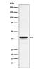 Forkhead box protein F1 antibody, M03563, Boster Biological Technology, Western Blot image 