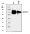 ADAM Metallopeptidase Domain 10 antibody, A00566-5, Boster Biological Technology, Western Blot image 