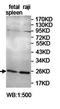 RAB37, Member RAS Oncogene Family antibody, orb78153, Biorbyt, Western Blot image 