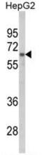 Heterogeneous Nuclear Ribonucleoprotein L antibody, GTX81942, GeneTex, Western Blot image 