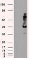 Intraflagellar Transport 57 antibody, NBP2-02313, Novus Biologicals, Western Blot image 