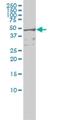 RIO Kinase 3 antibody, H00008780-M01, Novus Biologicals, Western Blot image 