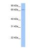 Zinc Finger Protein 317 antibody, NBP1-80352, Novus Biologicals, Western Blot image 